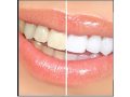 your-dentist-in-thousand-oaks-ca-small-1