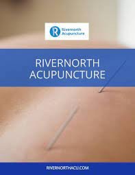 rivernorth-acupuncture-clinic-general-service-big-1